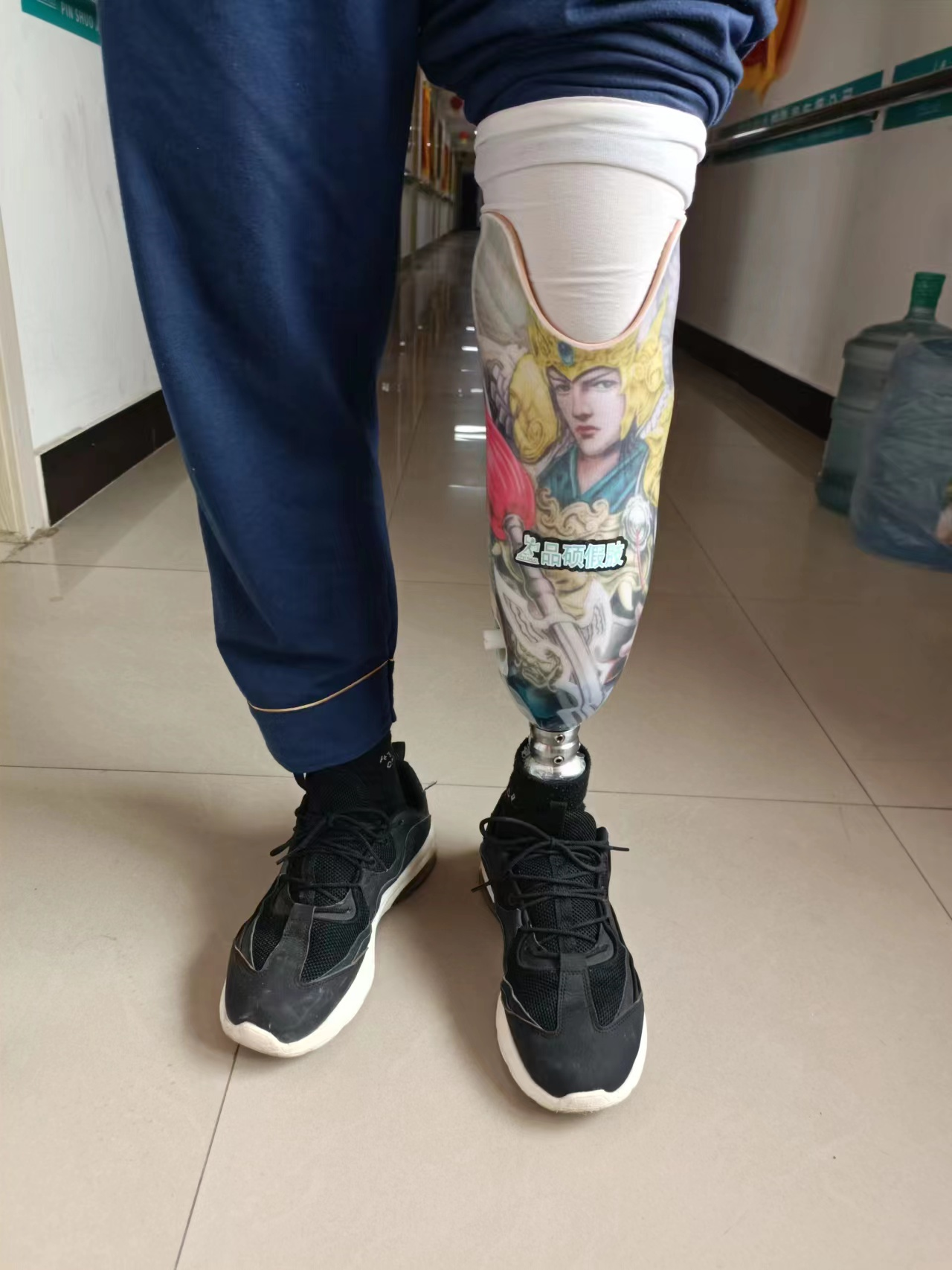 小腿截肢安装假肢后的康复过程