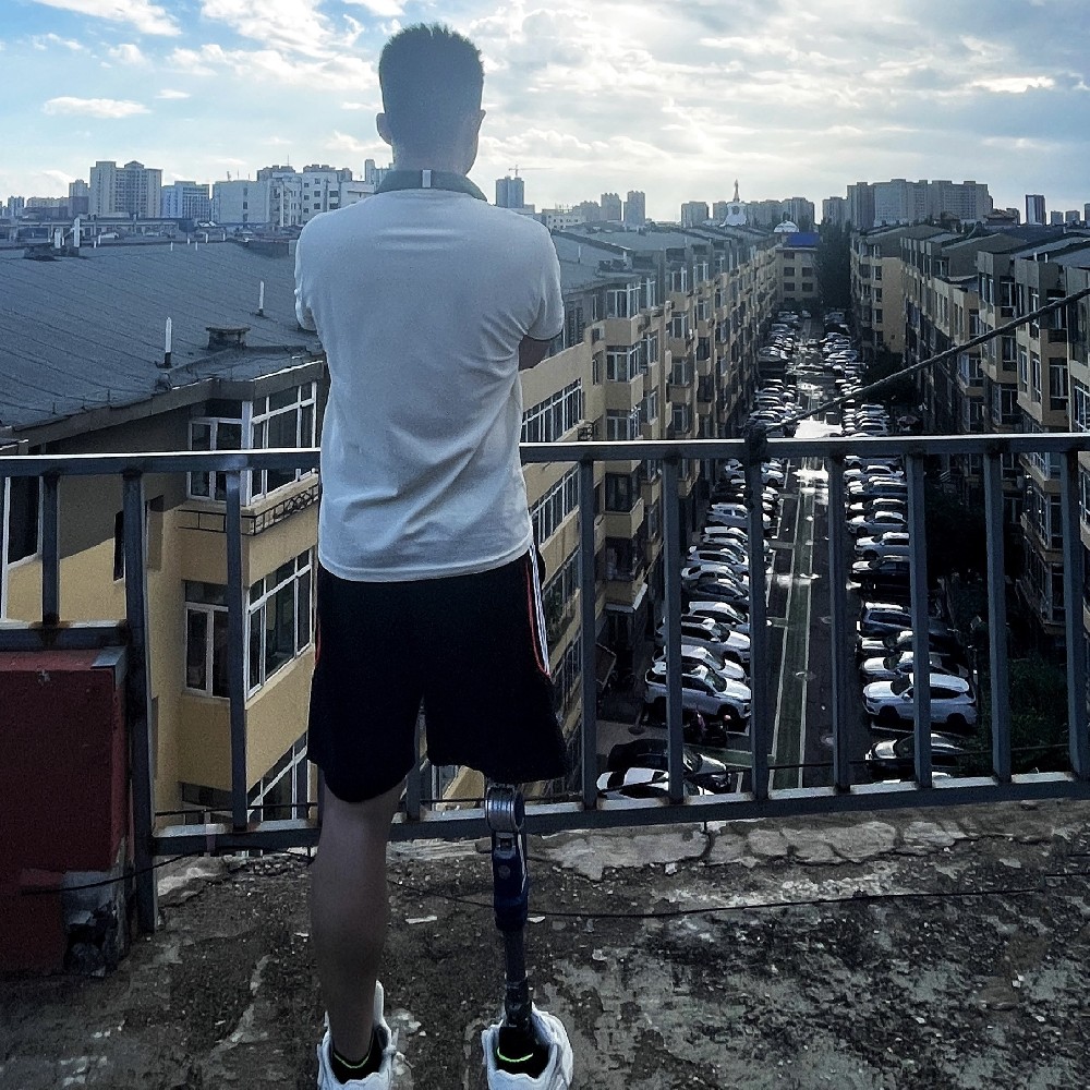 截肢后的阴雨天